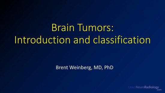 Brain tumors - topic guide