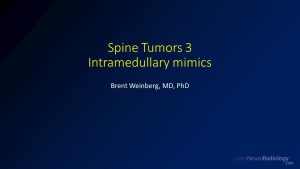 screenshot from spine tumors 3 intramedullary mimics