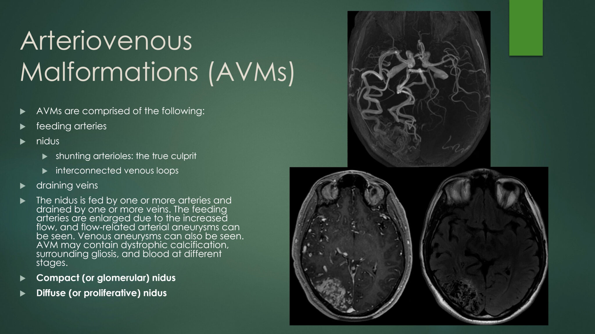 Understanding Vascular Malformations Of The Spine