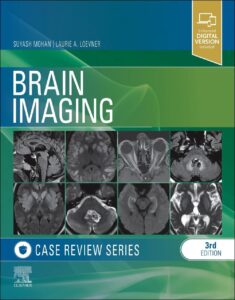 Core review series brain imaging book cover