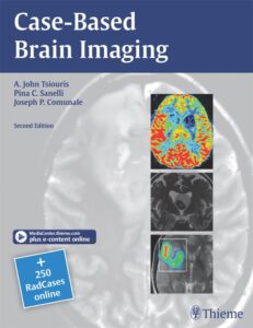 Case based brain imaging book cover