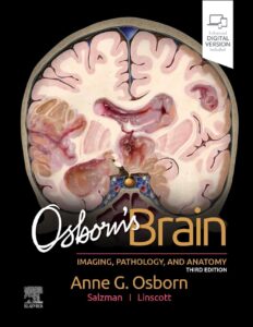 Osborn's Brain book cover