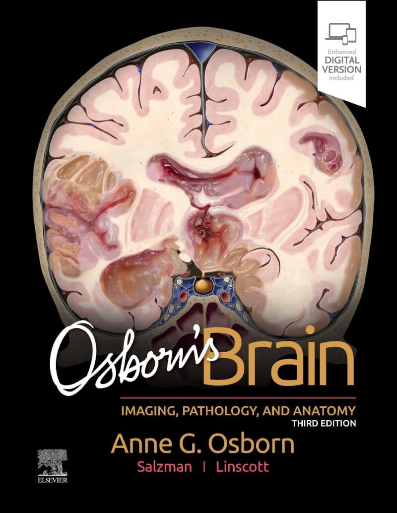 Best neuroradiology books - Learnneuroradiology