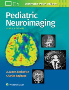 Barkovich Pediatric Neuroimaging book cover