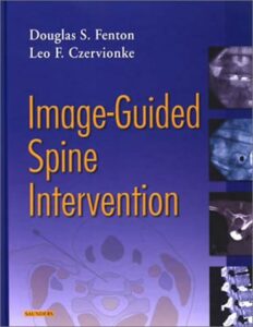 Image Guided Spine Imaging Book Cover